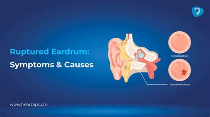 Are ruptured eardrum permanent?