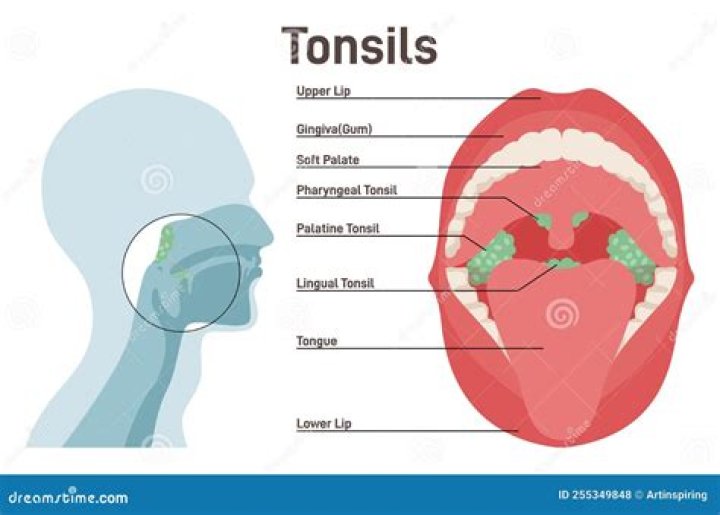 Are your tonsils located?