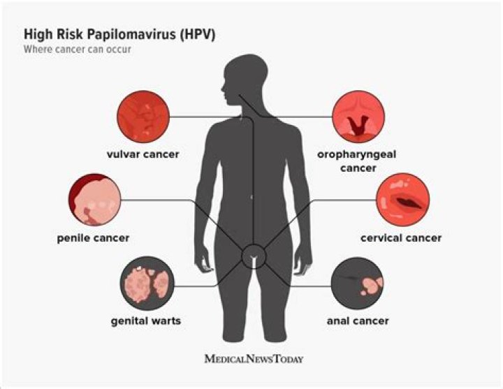 Is hpv a virus?