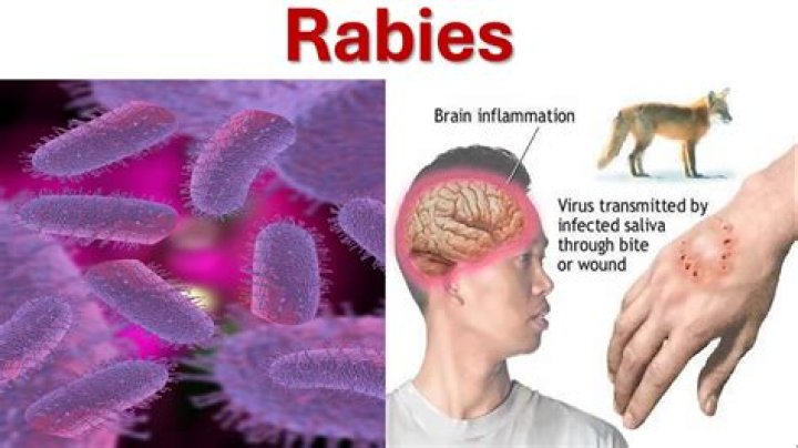 When do you get rabies?
