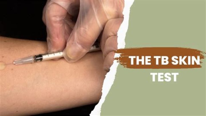 Where does concentra send urine tests?
